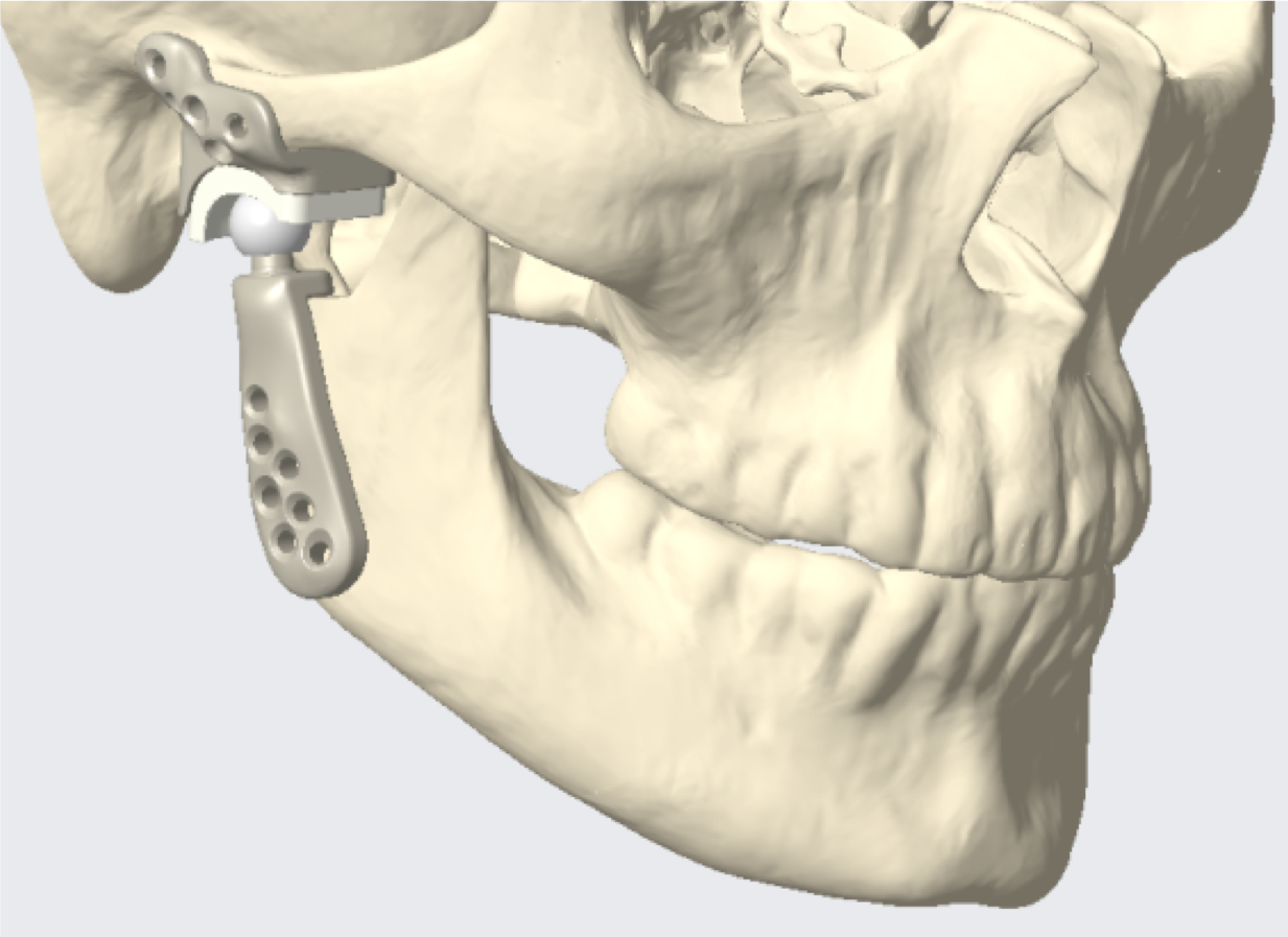 99-01tmj1911.png